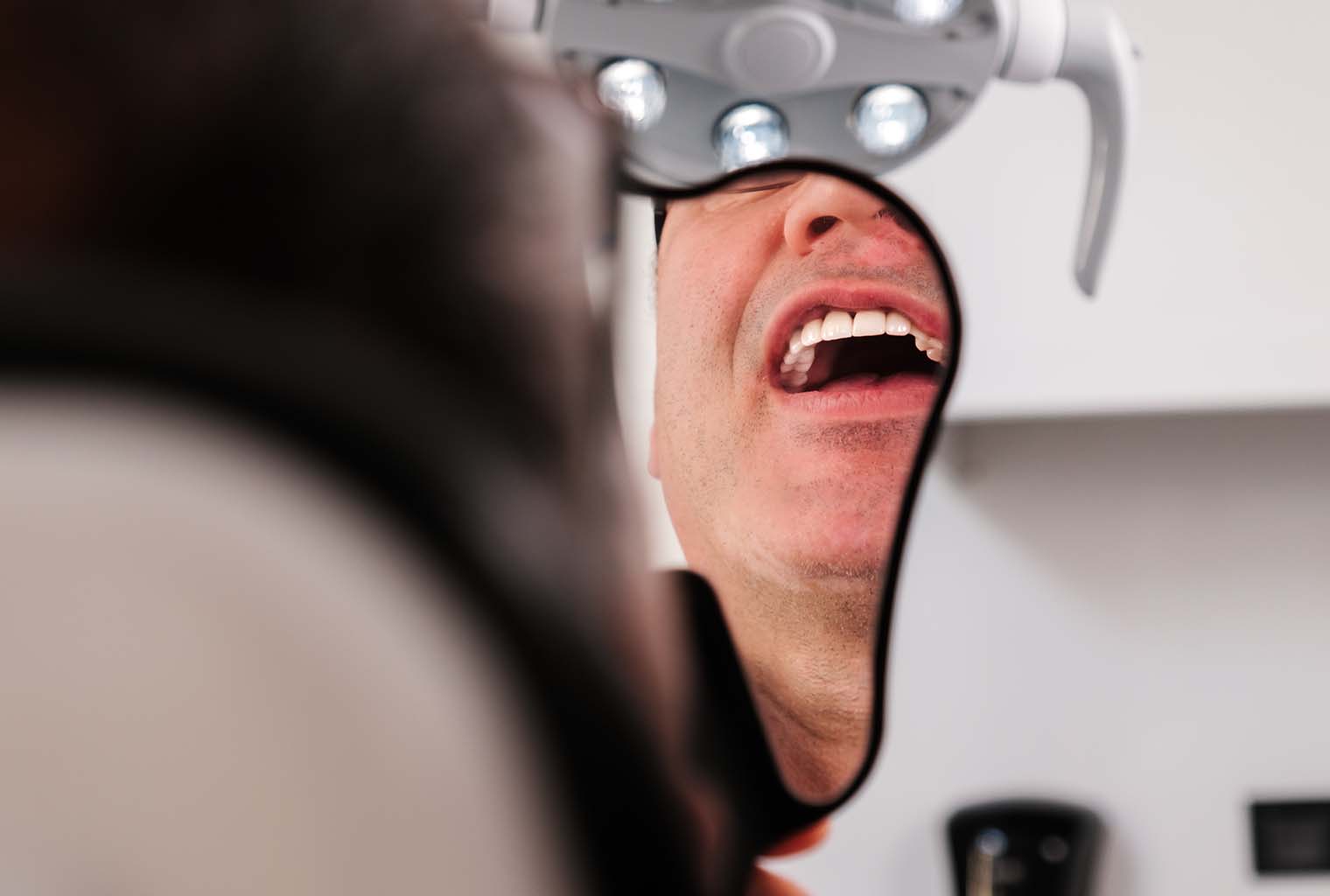 Teeth Whitening Methods and Comparison: Your Ultimate Guide